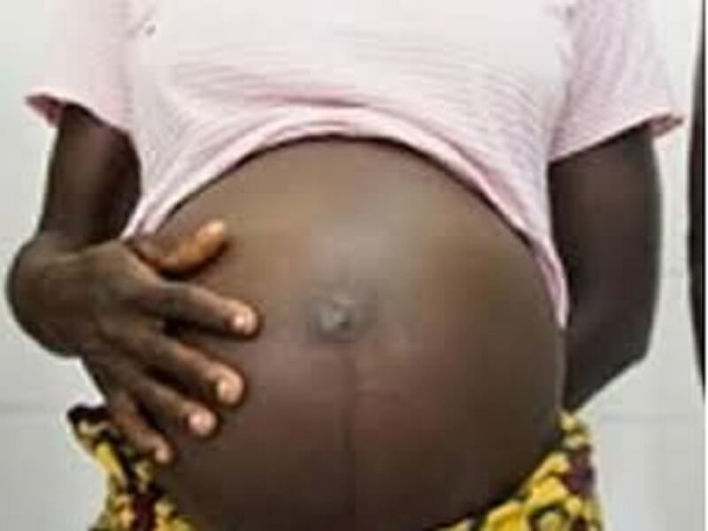 Image of a Pregnant Woman (For Illustrative Purposes Only)