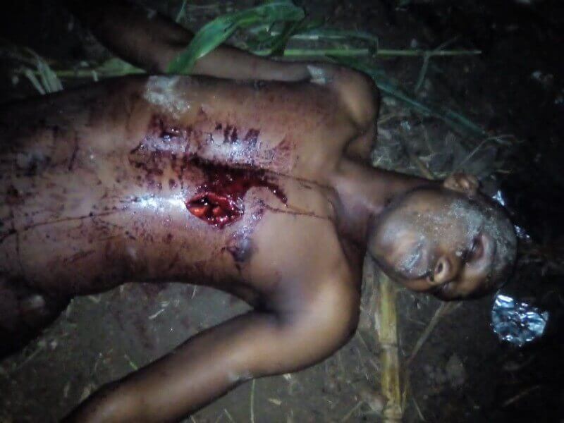 Boyfriend stabbed 1 1